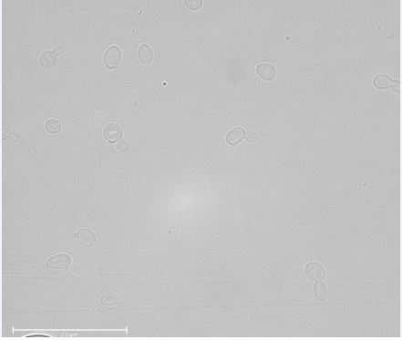 Scheffersomyces lignosus NRRL Y-12856T. Image by Katharina de Oliveira Barros.