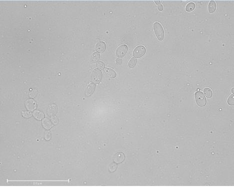 Scheffersomyces shehatae NRRL Y-12858T. Image by Katharina de Oliveira Barros.