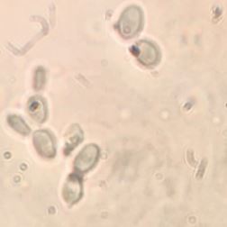 Scheffersomyces stipitis NRRL Y-7124. Image by David Krause.