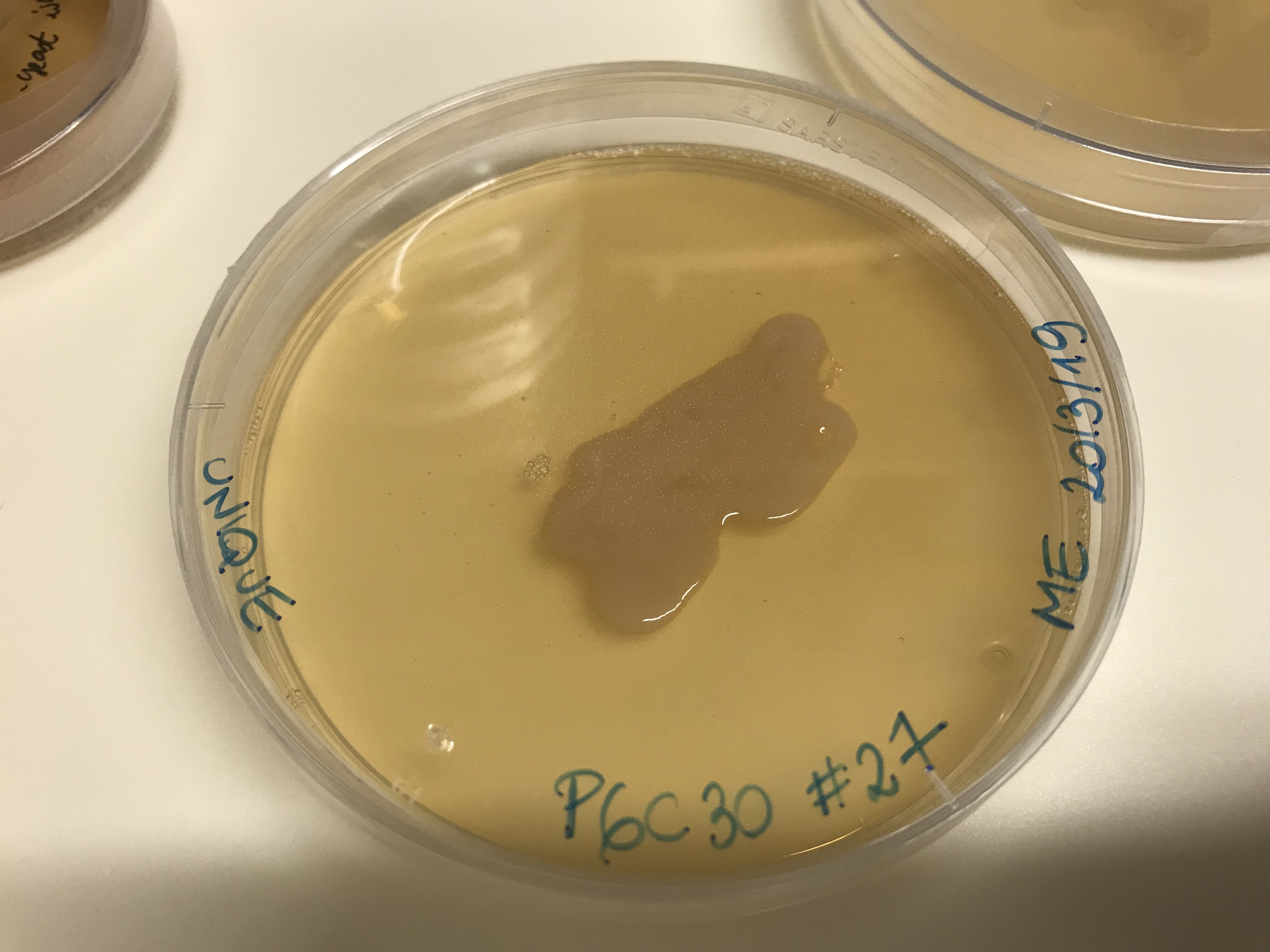 Photo of Microbotryomycetes incertae sedis isolate P6C30 v1.0