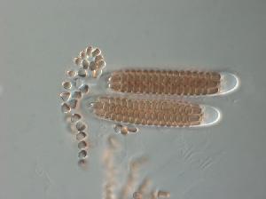 Asci and ascospores of Sporormia fimetaria
