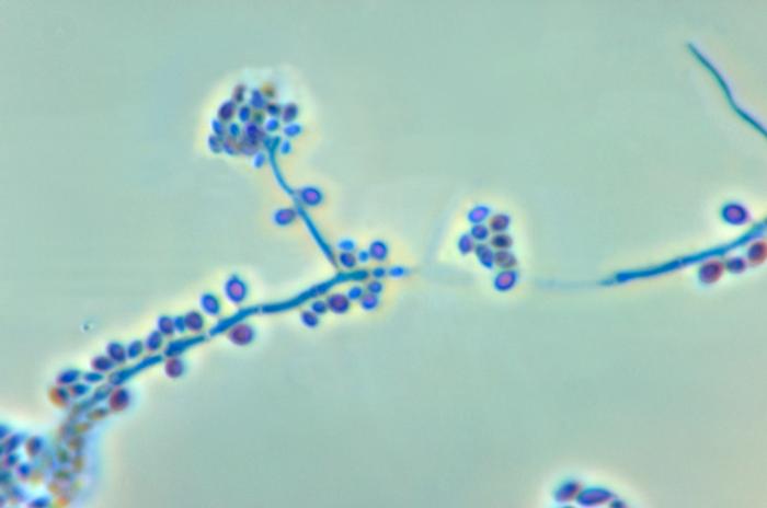 Conidiophores and conidia of the fungus Sporothrix schenckii.