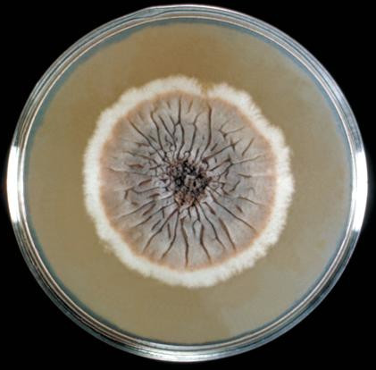 Sporothrix schenckii growing on Sabouraud's dextrose agar plate. 