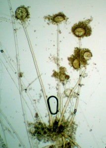 Several sporangia of Syncephalis fuscata (40X). Image by Dr. Gerald Benny