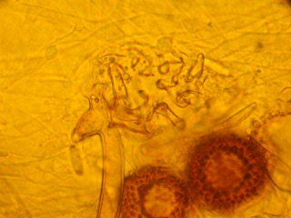 Two zygospores of Syncephalis plumigaleata.