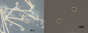 Photo of Syncephalis pseudoplumigaleata Benny S71-1 single-cell v1.0