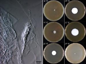 The left panel shows a microscopic picture of Thielavia hyrcaniae CBS 757.83 after 7 days growth on malt extract agar (MEA) medium. The right panel shows six colonies of Thielavia hyrcaniae CBS 757.83 after 7 days growth on MEA at six different temperatures. The figure is created by Cobus Visagie and Joost van den Brink.