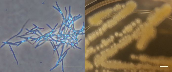 Cell morphology (left) and colony morphology (right) of Tilletiopsis sp. TKC 30. Bars = 20 microns (left) and 2.5 mm (right). Photo courtesy: Teeratas Kijpornyongpan.