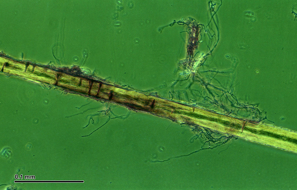 Trichophyton mentagrophytes from a microculture and an
infected hair