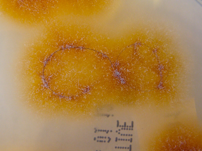 Trichophyton tonsurans on dermatophyte selective agar