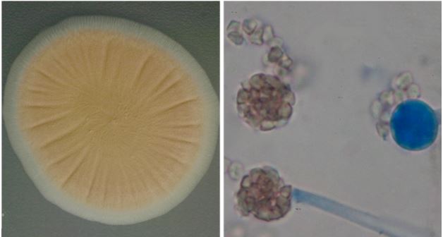 Colony of Umbelopsis sp. PMI123 growing on potato dextrose agar
(PDA; left) and under light microscopy (right). Umbelopsis is rich in lipids and
it produces terminal sporangia containing multiple sporangiospores.
Images by Alejandro Rojas.