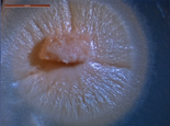 Valetoniellopsis laxa by Derek Johnson
