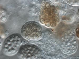 Asci and spores of Westerdykella ornata.