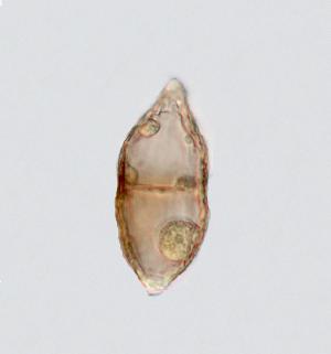 Ascospores of Zopfia rhizophila