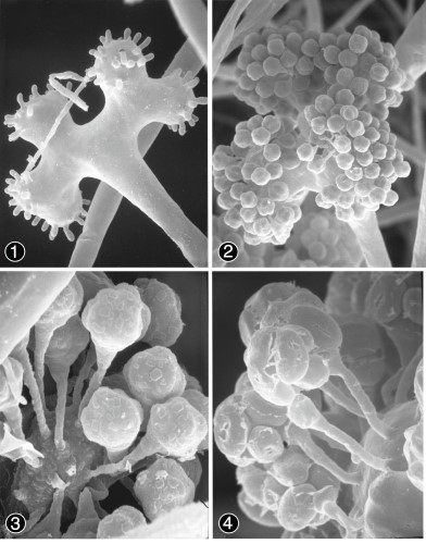 Figure 1) Multi-lobed branched, lateral sporangiophores. Figures
2-4) Globose, ovoid sporangioles and swollen columnella. Images by
Kerry O'Donnell